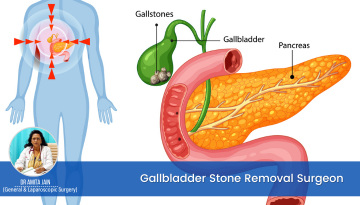 best gallstone removal doctor surgeon Dr Amita Jain